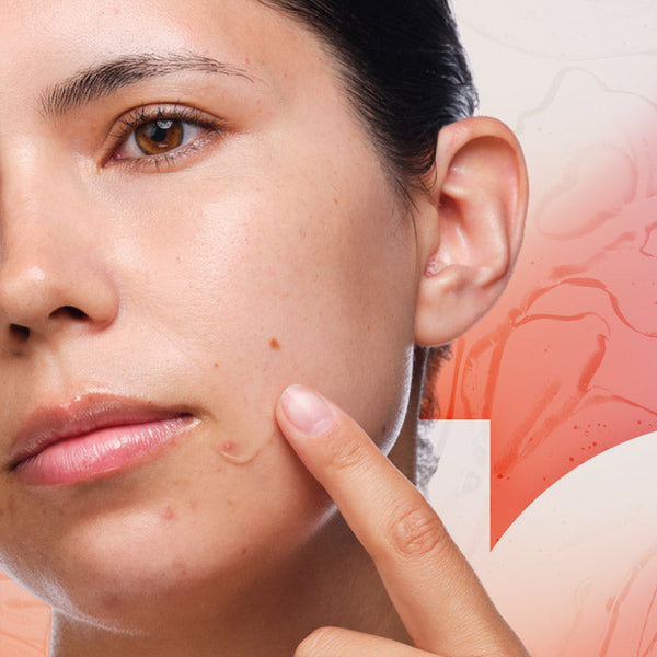 acne skincare products