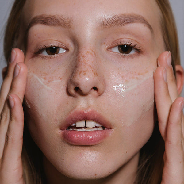SPF for Acne-Prone Skin