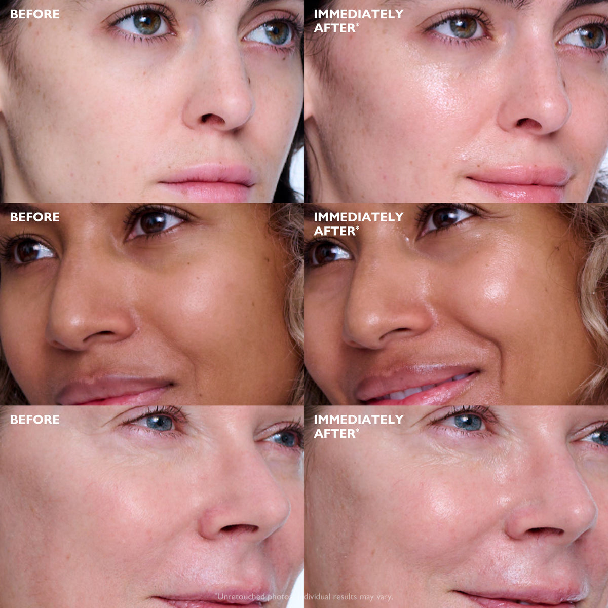 Peter Thomas Roth Collagen Skinjection™ Plumping & Firming Serum 30ml