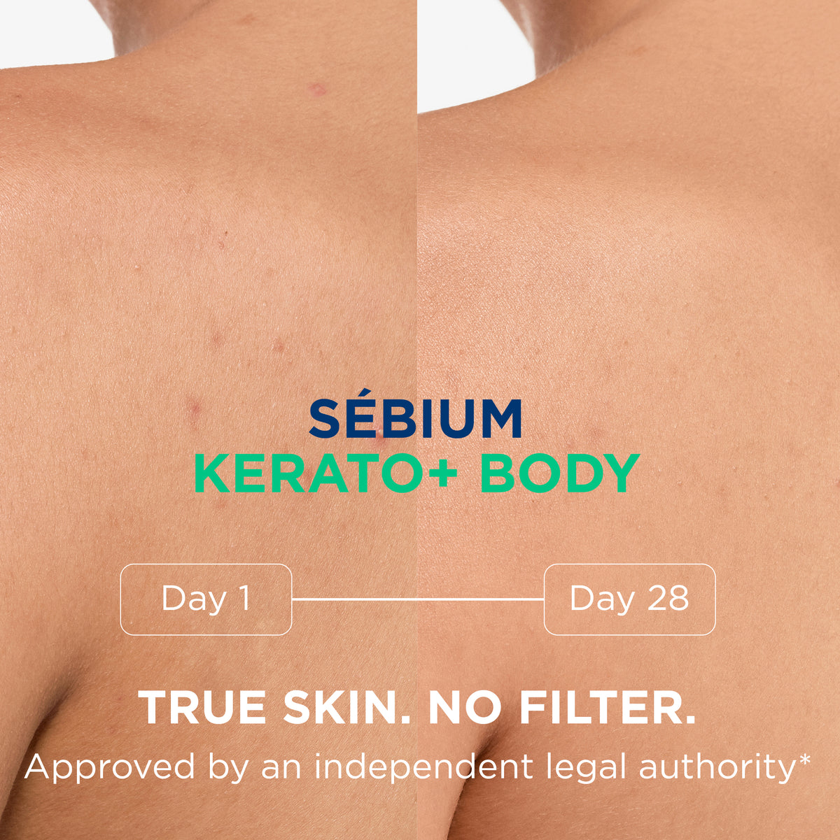 Bioderma Sebium Kerato+ Body Spray 150ml