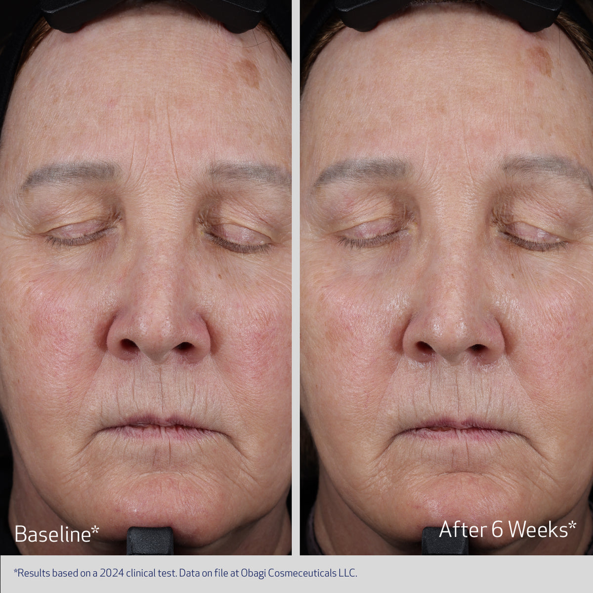 Obagi Elastiderm Lift Up & Sculpt Facial Moisturiser