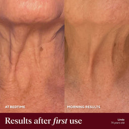Before and after comparison of skin texture at bedtime and morning results, showing visible improvement.