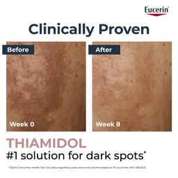 Eucerin Anti-Pigment Spot Corrector 5ml