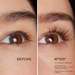 RevitaLash Lash & Brow Enhancement Bundle