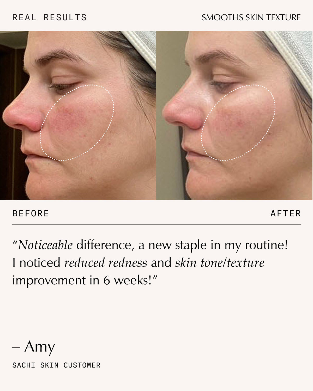 Sachi Skin Peptide Pro Resilience Serum Concentrate 30ml