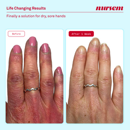 Nursem Skincare Discovery Set