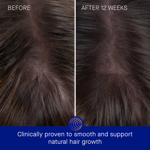 Augustinus Bader The Hair Oil