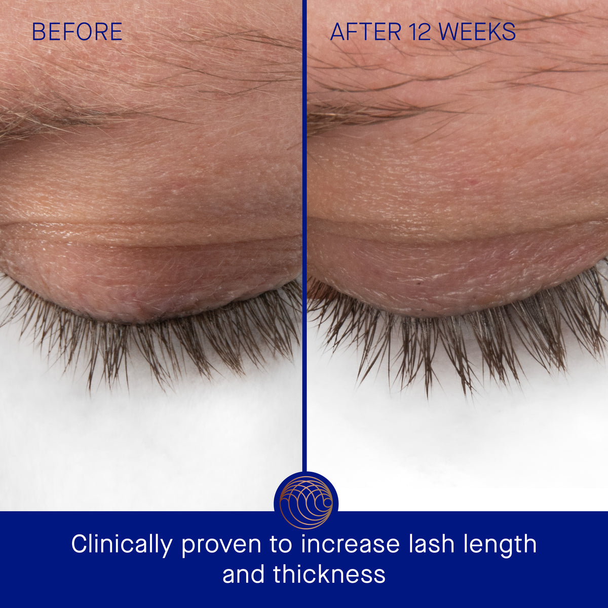 Augustinus Bader The Eyebrow & Lash Enhancing Serum 8ml