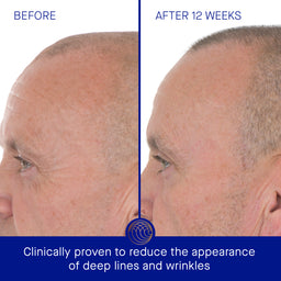 Augustinus Bader The Retinol Serum 15ml