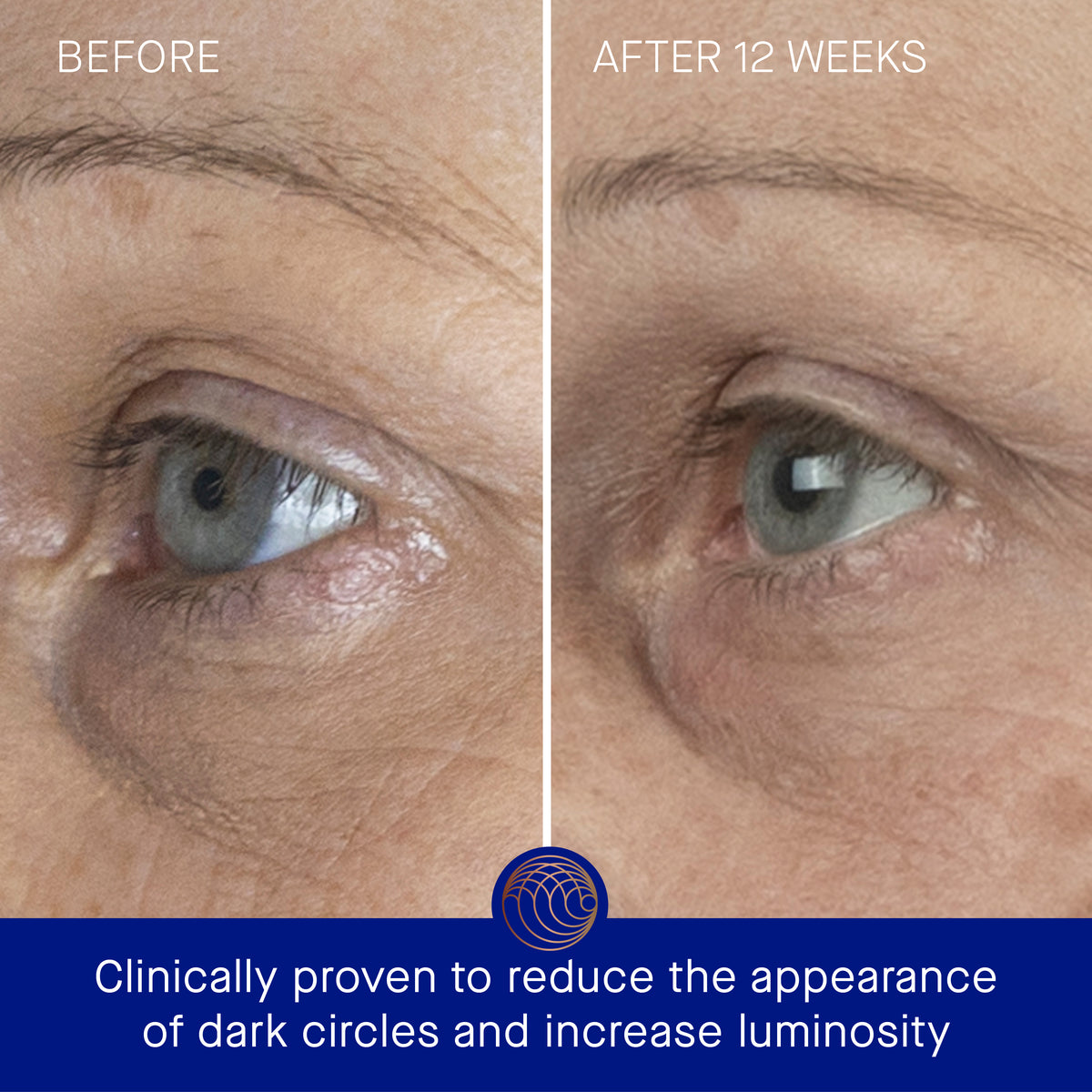 Augustinus Bader The Eye Cream