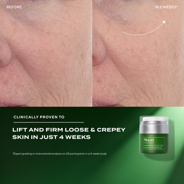 Before and after comparison of skin with a green Murad skincare product container.