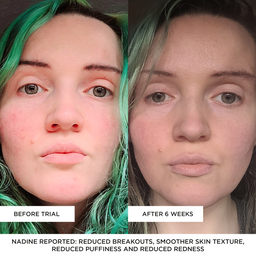 BEAUTYPRO PHOTON LED Light Therapy Mask