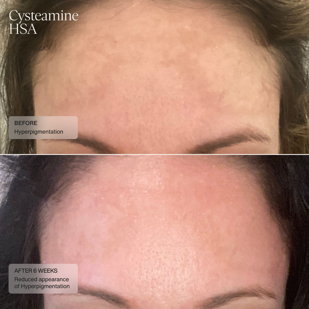Senté Dermal Repair Kit