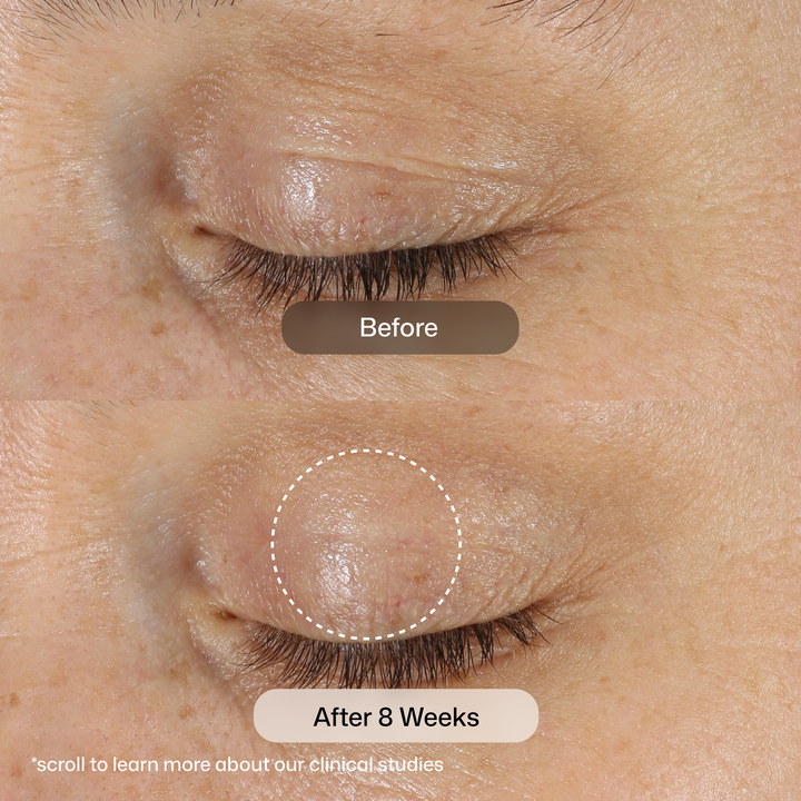 Close-up of a closed eye showing skin before and after 8 weeks of treatment, with a 'Before' label over the upper eye and an 'After 8 Weeks' label over the lower eye with a dotted outline highlighting smoother, less textured skin.