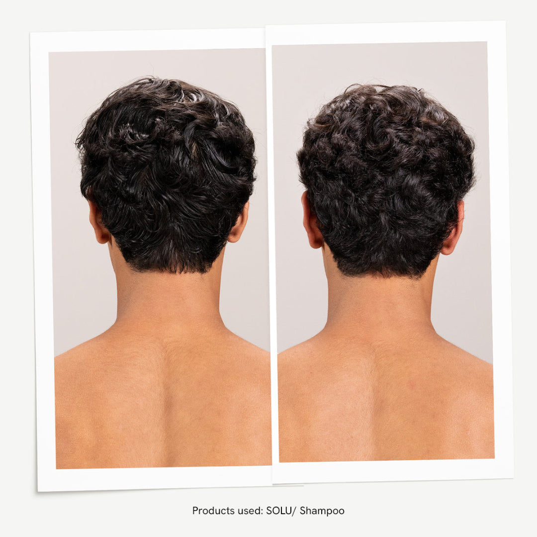 Before and after comparison of hair treatment with SOLU/Shampoo on a neutral background