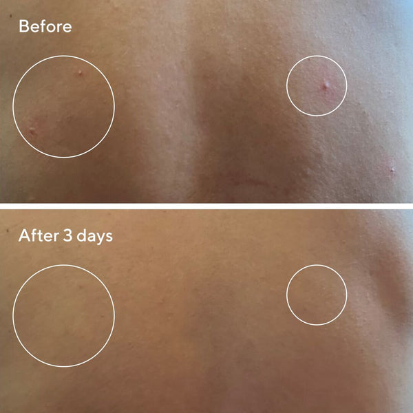 Murad Retexturizing Body Pads