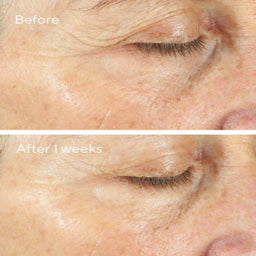 Murad Intense Recovery Cream