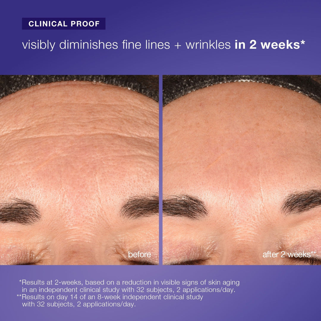 Before and after comparison of skin with fine lines and wrinkles on a purple background.