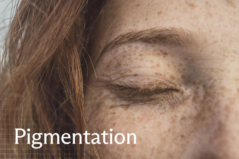 pigmentation skincare advice