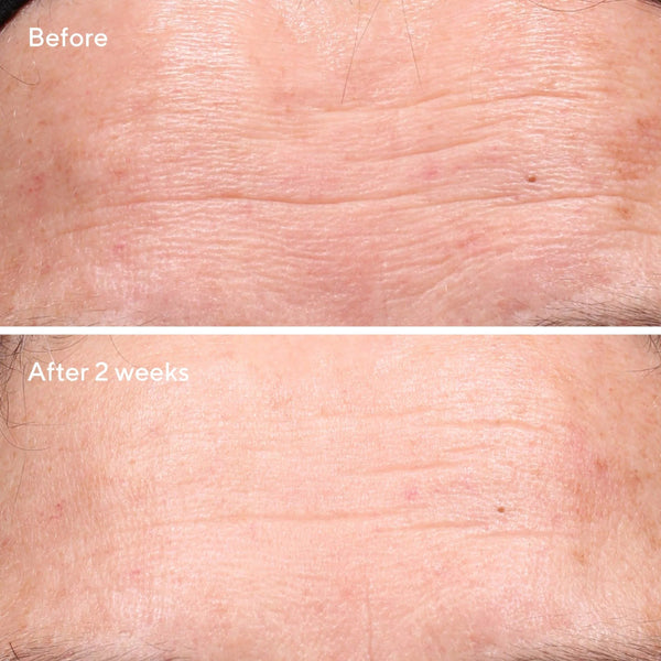 Murad Retinol Youth Renewal Serum