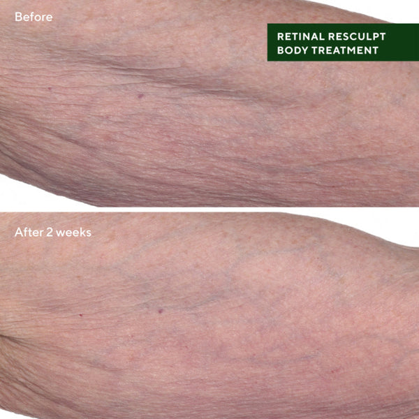 Murad Retinal ReSculpt Body Treatment