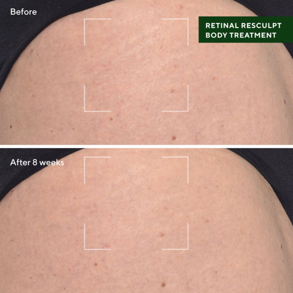 Murad Retinal ReSculpt Body Treatment