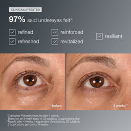 Dermalogica Smart Eye Density Serum 15ml