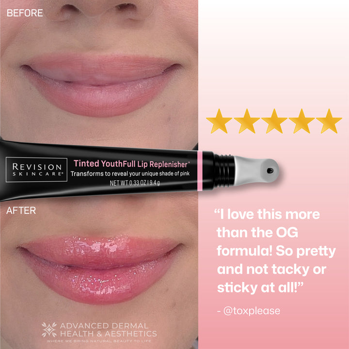 Before-and-after lip treatment comparison featuring a tube of Revision Skincare Tinted YouthFull Lip Replenisher, with close-up views of lips showing a pink tint, a five-star graphic, and a testimonial quote on a soft pink background.