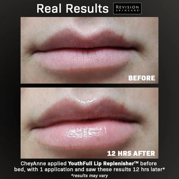Before and after comparison of lips with Revision Skincare branding, showing a visible improvement 12 hours later.