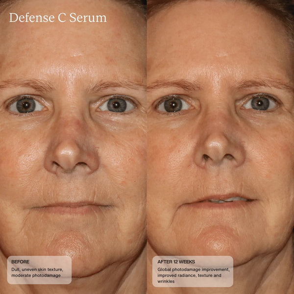 Senté Defense C Serum