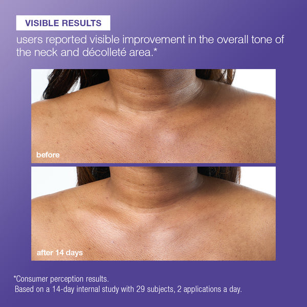 A purple informational graphic with text reading 'VISIBLE RESULTS' and a before/after comparison of a person's neck and upper chest, showing skin tone improvement after 14 days.