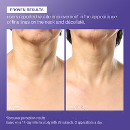 Before-and-after neck skin comparison showing visible improvement in fine lines after 14 days, with text stating 'PROVEN RESULTS' on a purple background.