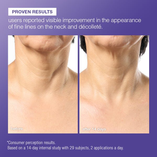 Before-and-after neck skin comparison showing visible improvement in fine lines after 14 days, with text stating 'PROVEN RESULTS' on a purple background.