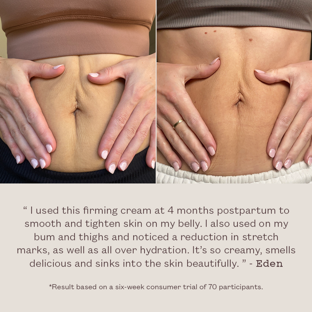 Before and after comparison of a person's belly with hands touching, showing the effect of a firming cream.