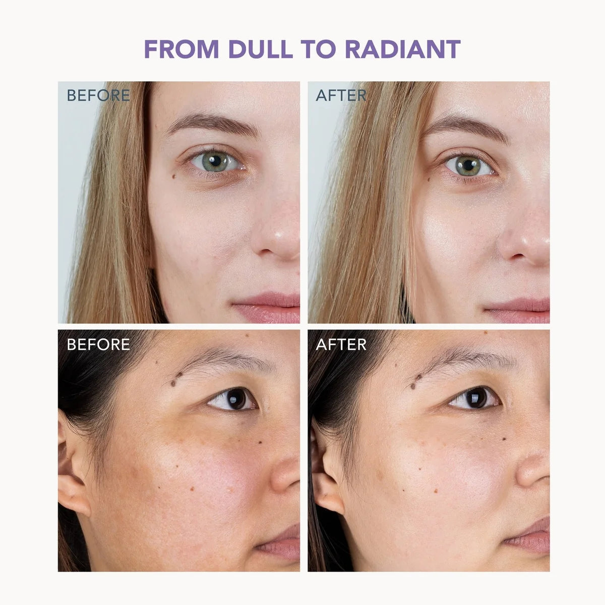 Before and after skin comparison collage showing two women's faces with the text 'FROM DULL TO RADIANT' at the top, demonstrating skincare or cosmetic results.