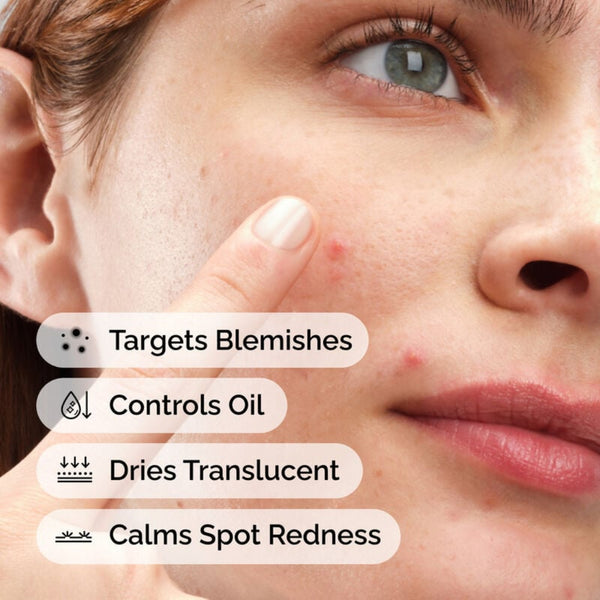 Close-up of a person's face with acne, showing text about skincare product benefits.