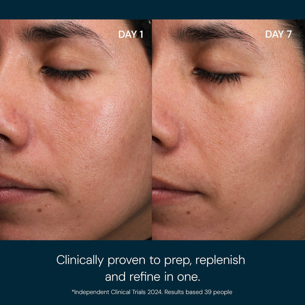 Before and after comparison of a person's face with text indicating clinical provenance.