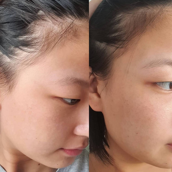 Vida Glow Hairology before and after