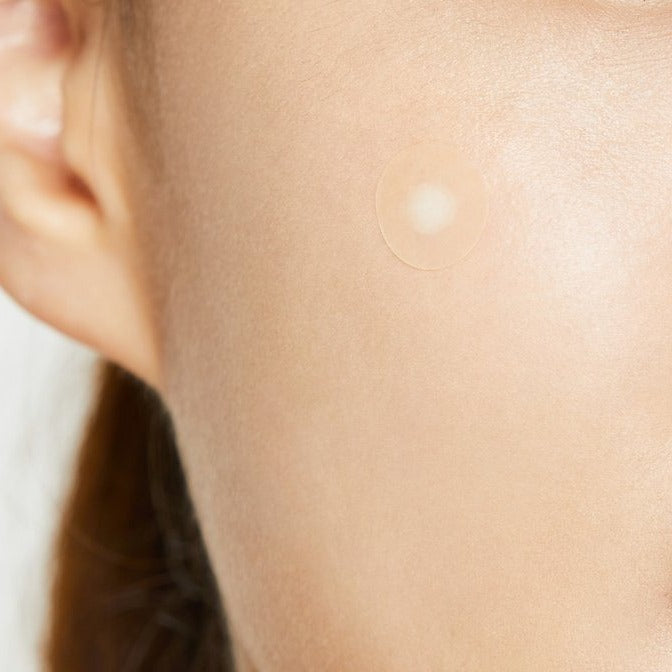 COSRX Acne Pimple Master Patch on a models face