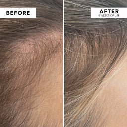 WE ARE PARADOXX Growth Advanced Scalp Serum 50ml before and after